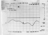 2.4 gHz Loss